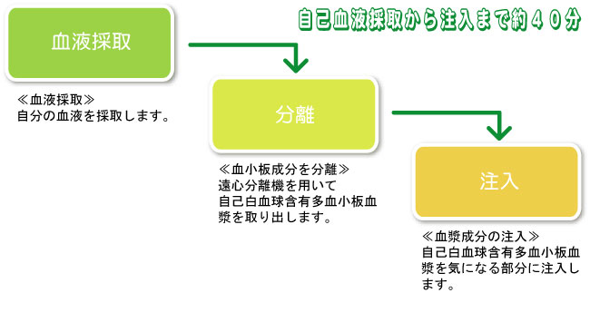 自己血液採取から注入まで約４０分