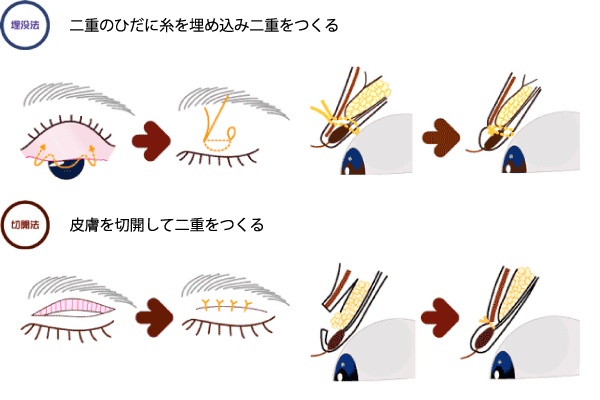 この画像をクリックすると拡大表示されます。